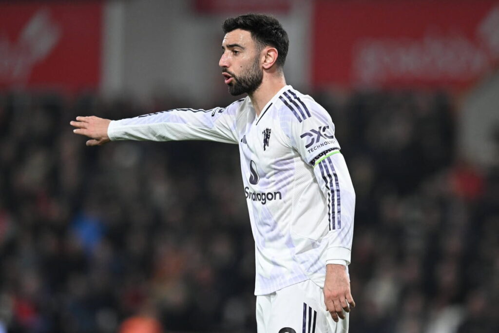 Manchester United, typy